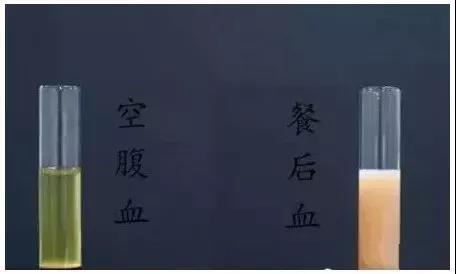 抽血检查的时候,为什么要空腹?看完你就懂了!(图2)