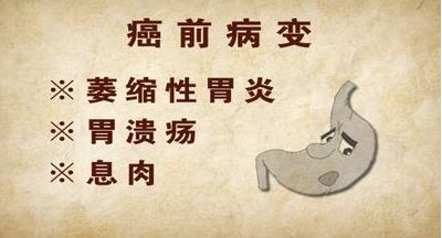 胃息肉：往前一步就是胃肿瘤!发现胃息肉，建议你这么做!(图3)