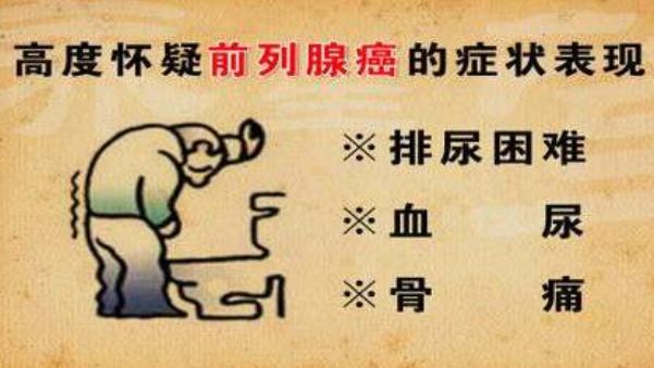 前列腺增生别忽视,治疗不当或变为前列腺肿瘤,几个...(图3)