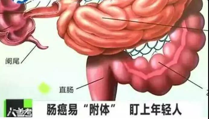 【提醒】大数据显示,中国39岁以下患肿瘤人数飙升....(图3)