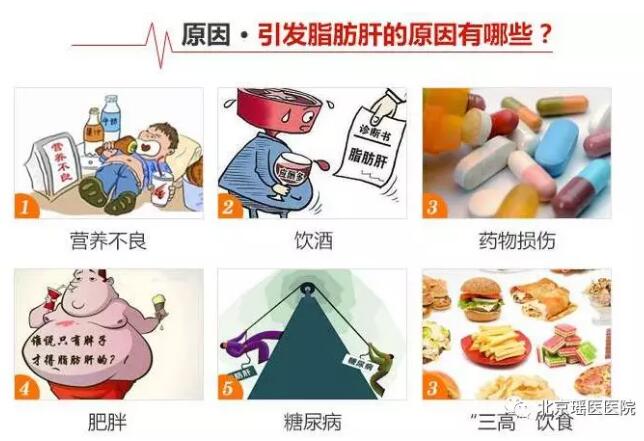 这种病跟胖不胖没半毛钱关系!不注意饮食，它就自动找上门(图4)