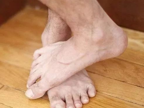 肝不好,脚先知,一旦有这些症状说明肝在求救(图1)