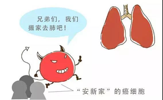 癌细胞发生转移的四个方式！做好以下五点，癌症远离你(图2)