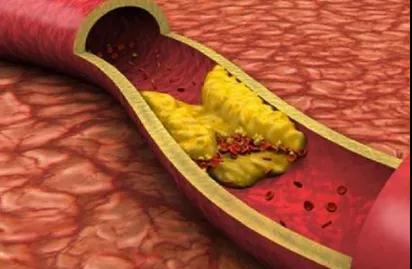 研究血管60年,90岁院士的“养生箴言”,对中老年人太有用(图2)