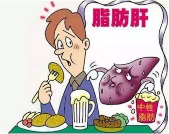 脂肪肝患者比正常人患肝肿瘤几率高百倍，已成为中青年男(图2)